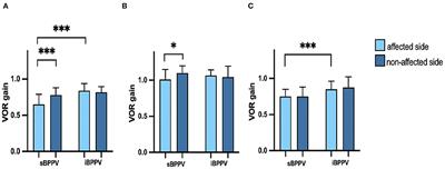 Video Head Impulse Test Findings in Patients With Benign Paroxysmal Positional Vertigo Secondary to Idiopathic Sudden Sensorineural Hearing Loss